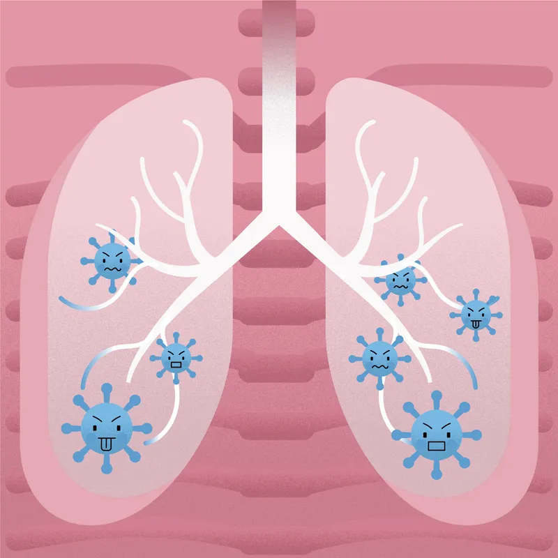 Симптомы пневмонии у детей: как распознать и когда обращаться к врачу